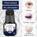 5 Pcs Cluster Lash Glue - 5ml Strong Hold Lash Bond | Eyelash Glue for Lash Extensions Cluster Lash Glue Clear Lash Bond for Cluster Lashes Waterproof Ondian - Buy Online on GoSupps.com