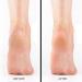 DeEnti Pumice Stones - 6 Pack Professional Grade Foot Callus Remover | Salon Quality Double Sided Pedicure & Manicure Tools - Buy Online on GoSupps.com