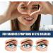 New Anti-Fatigue Clear Vision Eye Drops Eye Drops Relieve Red Eyes and Dry Eyes Cooling Eye Strain Relief Clear Eyesight Nursing Astigmatism - Buy Online on GoSupps.com