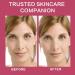 3 Pack Rose Hyaluronic Acid Serum for Face | Moisturize & Smooth Wrinkles | 1fl.oz | Rosa Rugosa Flower Water - Buy Online on GoSupps.com