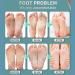 20ml Foot Treatment Spray for Odour Control and Cracked Heel - Feet Care Solution for Foot and Shoe Odor - Buy Online on GoSupps.com
