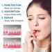 Carti Position Protein Dental Regrowth Drops | Deep Cleaning for Tooth Stains & Tartar | Swollen Gums Care | Enhance Your Dental Care - Buy Online on GoSupps.com