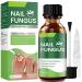 Toenail Fungus Treatment Extra Strength Toenail Fungus Treatment Nail Fungus Treatment Extra Strength for Athletes Foot Thick Broken Discolored & Damaged Nail-30Ml Green 1 Fl Oz (Pack of 1) Green