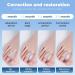 Adjustable Bunion Corrector & Toe Spacers for Men & Women - Bunion Relief Yoga Toes Separators Athletic Toe Aligners (1 Pair) - International Shipping Available - Buy Online on GoSupps.com