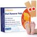 Folocone Wart Remover 24pcs Wart Removal Plasters Pads Wart Remover for Hands Plantar Wart Remover for Feet Verruca plasters Verruca Treatment Painlessly Removes Common and Plantar Warts 24 Count (Pack of 1)