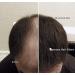 Samson Hair Building Fibers Refill - Compatible with Toppik 100% Undetectable Hair Loss Concealer for Thinning Hair - Black 25g Made in USA - Buy Online on GoSupps.com