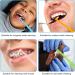 8 Pack Interdental Toothbrushes - Detailed Cleaning for Braces | Narrow & Jaw-Friendly - Buy Online on GoSupps.com