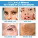 Face Serum for Women - 15% Niacinamide Serum - Hyaluronic Acid Serum for Face - Dark Spot Correcting Glow Serum - Moisturizing Collage Face Serum - Reduce Acne Nourish - Buy Online on GoSupps.com