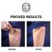 Keratosis Pilaris Exfoliating Body Lotion - 12% Lactic Acid for Smooth Skin | Immediate Moisture & Gentle Exfoliation - Buy Online on GoSupps.com