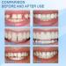 Grgowe Dental Adhesive & Temporary Dental Repair Kit for Provisional Dentures | Tooth Repair Set & Prosthesis Materials - Buy Online on GoSupps.com