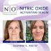N1O1 Nitric Oxide Activating Serum | Antioxidant-Rich Hydrating Face Serum | Decreases Wrinkles, Minimizes Pores, Improves Skin Texture | 1 Fl Oz - Buy Online on GoSupps.com