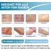 High-Quality Silicone Scar Patches for C-Section Burns Keloids & Acne - 6-8 Month Supply (4CM x 150CM) - Buy Online on GoSupps.com