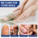 3 Pcs German Paronychia Oil for Toenail Care | Repair & Improve Toenail Health - Buy Online on GoSupps.com