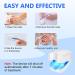 Anyork Toenail Fungus Treatment - Automatic Nail Fungal Cleaning Device - Buy Online on GoSupps.com