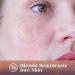 AUSLKA Pimple Patches (174 Patches) - Hydrocolloid Patches - Invisible Pimple Spot Stickers - Facial Stickers All Skin Types - Buy Online on GoSupps.com