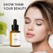 Dark Spot Remover for Face - Korean Glow Serum with Niacinamide & Acid for Acne Melasma & Freckles | 1.6 Fl Oz - Buy Online on GoSupps.com