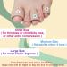 Skyfoot Gel Toe Sleeve - Toe Tubes Protectors for Blister, Corn, Calluses, Bunion, Hammertoes - Large Size - Buy Online on GoSupps.com