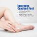 Urea Foot Cream - Cracked Heel Repair Cream - Foot Cream for Cracked Heels and Dry Skin - Urea 10% Foot Cream for Very Dry Feet - Deep Moisturizing for Feet Knees and Body Care - Buy Online on GoSupps.com