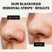 Activated Charcoal Nose Pore Strips - Blackhead Remover & Pore Cleanser - 4 Pcs - Buy Online on GoSupps.com