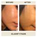 AziMD Skincare Clarify Pads for Face & Body Acne | 2% Salicylic & Glycolic Acid - International Shipping Available - Buy Online on GoSupps.com