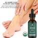 Naturenics Tea Tree Essential Oil - 100% USDA Organic Melaleuca Alternifolia - Therapeutic Grade for Acne, Toenail, Lice, Hair, Face & Skin Issues - 1 Fl Oz - Buy Online on GoSupps.com