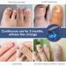 Rechargeable Nail Fungus Laser: Home Use LED Light Treatment - SUNCKY - Buy Online on GoSupps.com