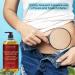 Majestic Pure Frankincense Massage Oil | Scar & Stretch Mark Treatment | 8 fl oz - Buy Online on GoSupps.com
