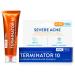 AcneFree Terminator 10 Spot Treatment - Maximum Strength Benzoyl Peroxide Acne Cream (2 Pack 1 oz) - Effective Acne Control - Buy Online on GoSupps.com