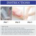 DermaCure Herbal Psoriasis Relief Treatment Spray for Skin Plaque Psoriasis - Buy Online on GoSupps.com