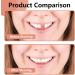 Flipped Warm Tooth Aperture - Comfortable Upper & Lower False Teeth for Perfect Smile | Flexible Braces - Buy Now! - Buy Online on GoSupps.com