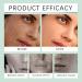  HNYXEQJL Set of 8 pigment spot correcting creams acne cream for women and men brightening balm for pores and pigment spots nourishing and soothing serum and - Buy Online on GoSupps.com