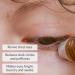 Brightening Vitamin C Eye Serum for Dark Circles & Puffiness - Hydrating & Anti-Aging Formula 3 fl. oz - Buy Online on GoSupps.com
