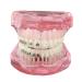 Teeth Model Dental Orthodontic with Metal and Ceramic Brackets for Teeth Study Model