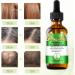 Rosemary Oil for Hair Growth Natural Organic Rosemary Essential Oil and Derma Roller Diluted for Eyelash Beard Eyebrows Face Skin Care Hair Loss Treatment Nourishes The Scalp Improve Blood Circulation - Buy Online on GoSupps.com