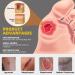 Bedsore Cream Bedsore Wound Care Pressure Sore Relief Cream Fast-Acting Healing Cream for Bed Sores - Buy Online on GoSupps.com