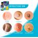 Salicylic Wart Removal Freeze Away - Maximum Strength Fast-Acting Verrugas Treatment for Men & Women | 15ml for Plantar Warts Genital Warts Corns Moles & Calluses - International Shipping Available - Buy Online on GoSupps.com