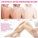 Purer Intimate Whitening Cream for Underarms, Knees, and Intimate Areas - Buy Online on GoSupps.com