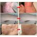 Anti-Itch Eczema Skin Health Spray - Pi Fu Hu Li Bao Jian Ye - Buy Online on GoSupps.com