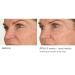 NassifMD Night Therapy Serum - Revitalize Skin Overnight | Shop Internationally - Buy Online on GoSupps.com