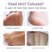 Ninnyi 2 Pairs Foot Peel Mask for Hard Skin Exfoliating Socks Peeling Foot Sock for Men Women - Buy Online on GoSupps.com