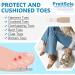 PrettSole 8-Piece Toe Splints & Support Brace Set for Broken, Hammer, and Overlapping Toes - Men & Women - Cushion and Protect Toes - Temporary Straighteners - Buy Online on GoSupps.com