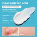 Azelaic Acid Face Cream + Butt & Back Acne Lotion Bundle Complete Face & Body Acne Care with Azelaic Acid Salicylic Acid & Niacinamide Helps Reduce Breakouts Bumps & Clogged Pores for Women Men - Buy Online on GoSupps.com