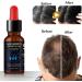 Nourishing Hair Growth Oil Serum for All Hair Types - Stimulates Scalp, Thickens and Promotes Density - 1pcs - Buy Online on GoSupps.com