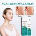 PARHAR Advanced Scar Repair Spray: For Facial Acne, Dark Spots, Surgical Scars, Stretch Marks - Gently Cares for Acne-Prone Skin, Relieves Itching - Suitable for All Scar Types - Buy Online on GoSupps.com