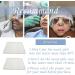 Thermoplastic Nasal Splints 5pcs-M Size (B) Medium - Nose Brace for Rhinoplasty & Septoplasty Surgery Support - Buy Online on GoSupps.com