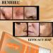 Calendula Peel Off Facial Mask - Blackhead & Pore Minimizer | Deep Cleansing Gold Mask for All Skin Types - Buy Online on GoSupps.com