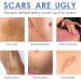CenryUSA Clear Scars Tape - Silicone Scar Tape for C-Section Surgery - Buy Online on GoSupps.com
