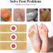 Beejoy 24pcs Wart Remover Pads for Painlessly Removing Common & Plantar Warts - Verruca Treatment for Hands & Feet - Buy Online on GoSupps.com