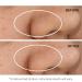 StriVectin Advanced Resurfacing Exfoliating Treatments - Brighter Complexion & Smooth Skin - Buy Online on GoSupps.com