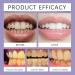 Gentle Care Toothpaste - Removes Stains/Tartar/Yellowing Freshens Breath Whitens Teeth for Daily Use(1PCS) 1 Fl Oz (Pack of 1) - Buy Online on GoSupps.com